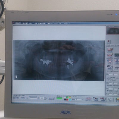 2013/11/08に雑色歯科クリニックが投稿した、その他の写真