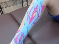 栃木キネシオ販売のキネシオテーピング指導（一般）の写真