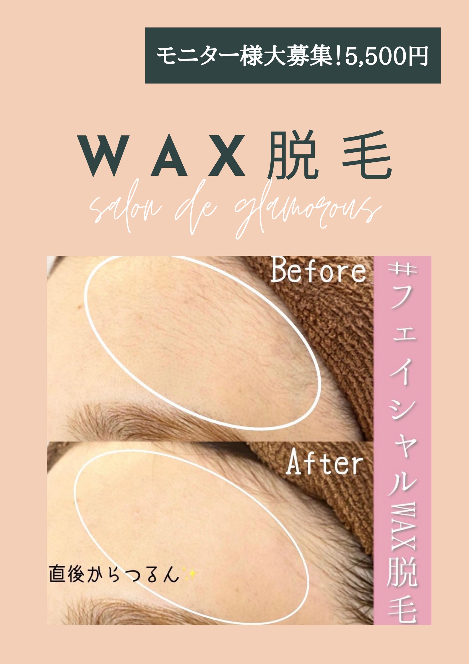 サロンドグラマラスのフェイシャルWAX脱毛の写真