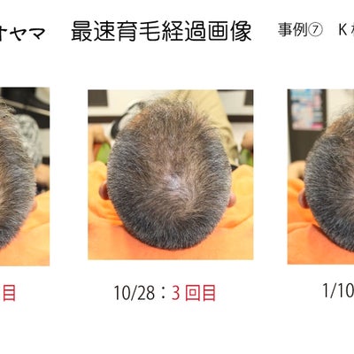 2017/01/21に髪師オヤマが投稿した、メニューの写真