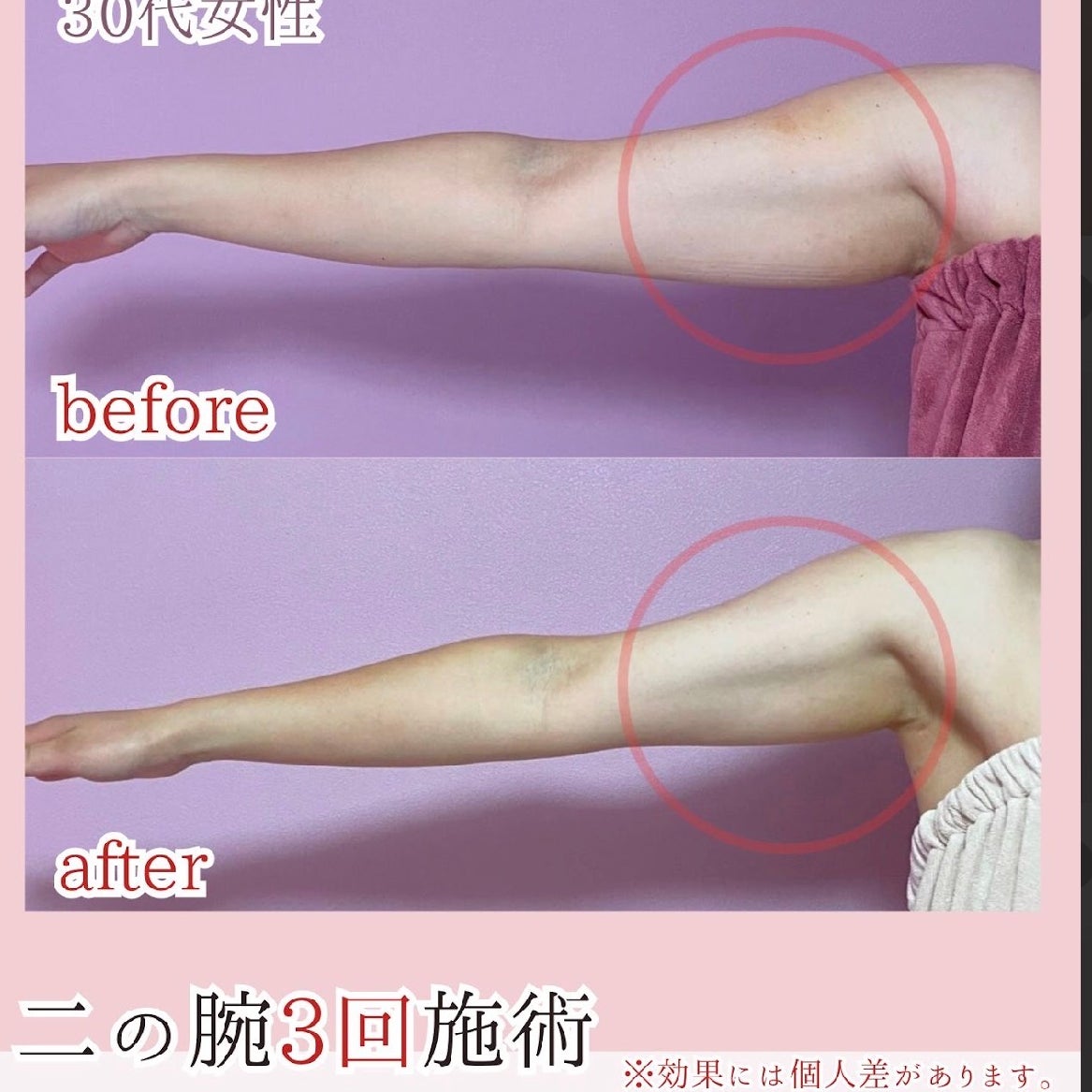 八王子エルモサ痩身脱毛_3枚目