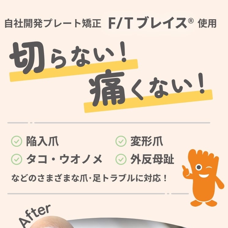 東京巻き爪矯正院【練馬院】_3枚目