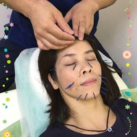 Macha鍼灸院の【美容鍼・表情筋アプローチはり】の写真