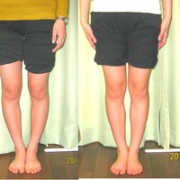 整体＆リラクゼーションcharaku(チャラク）の実績多数Ｏ脚Ｘ脚矯正（45分）の写真