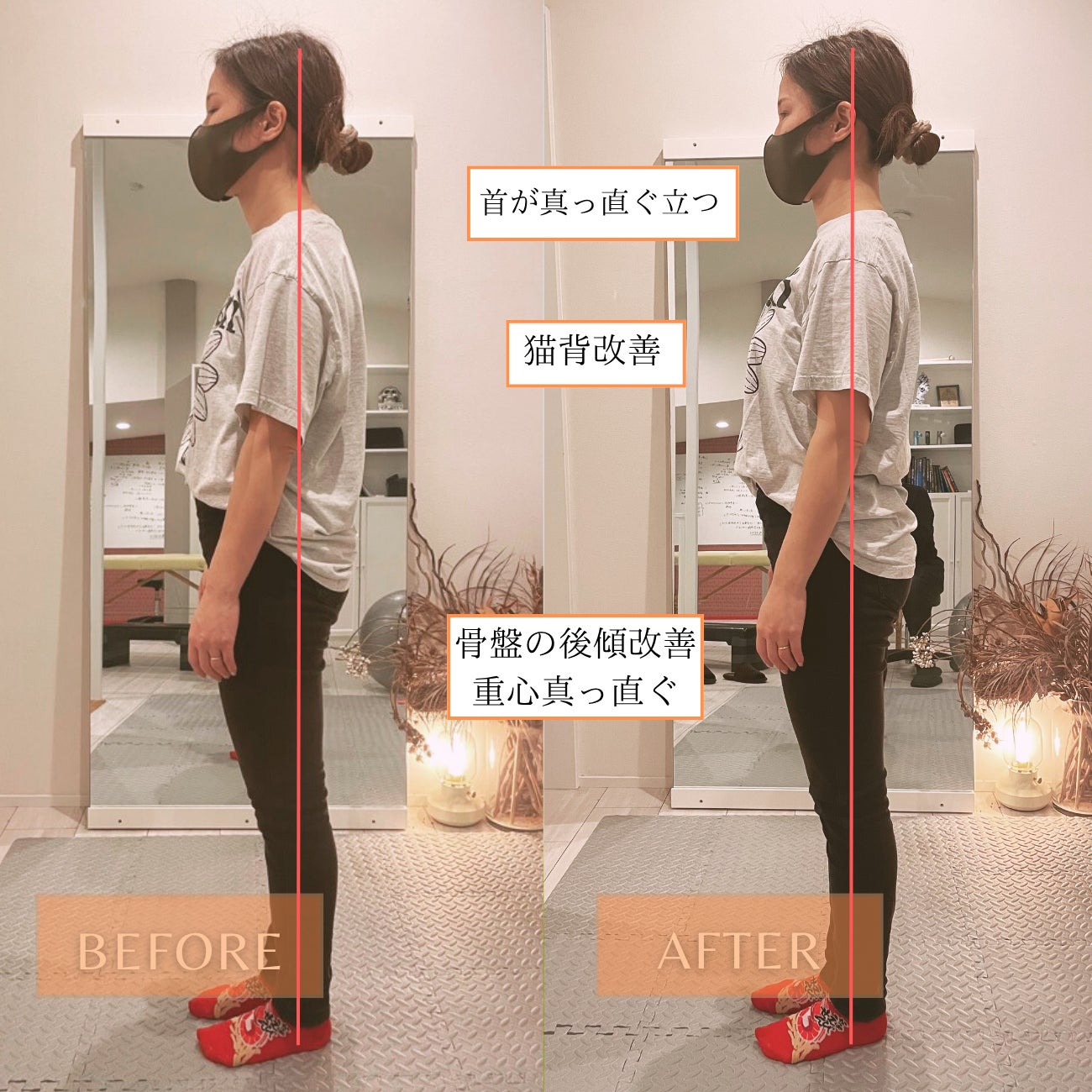 六甲美容整体Santelia_3枚目