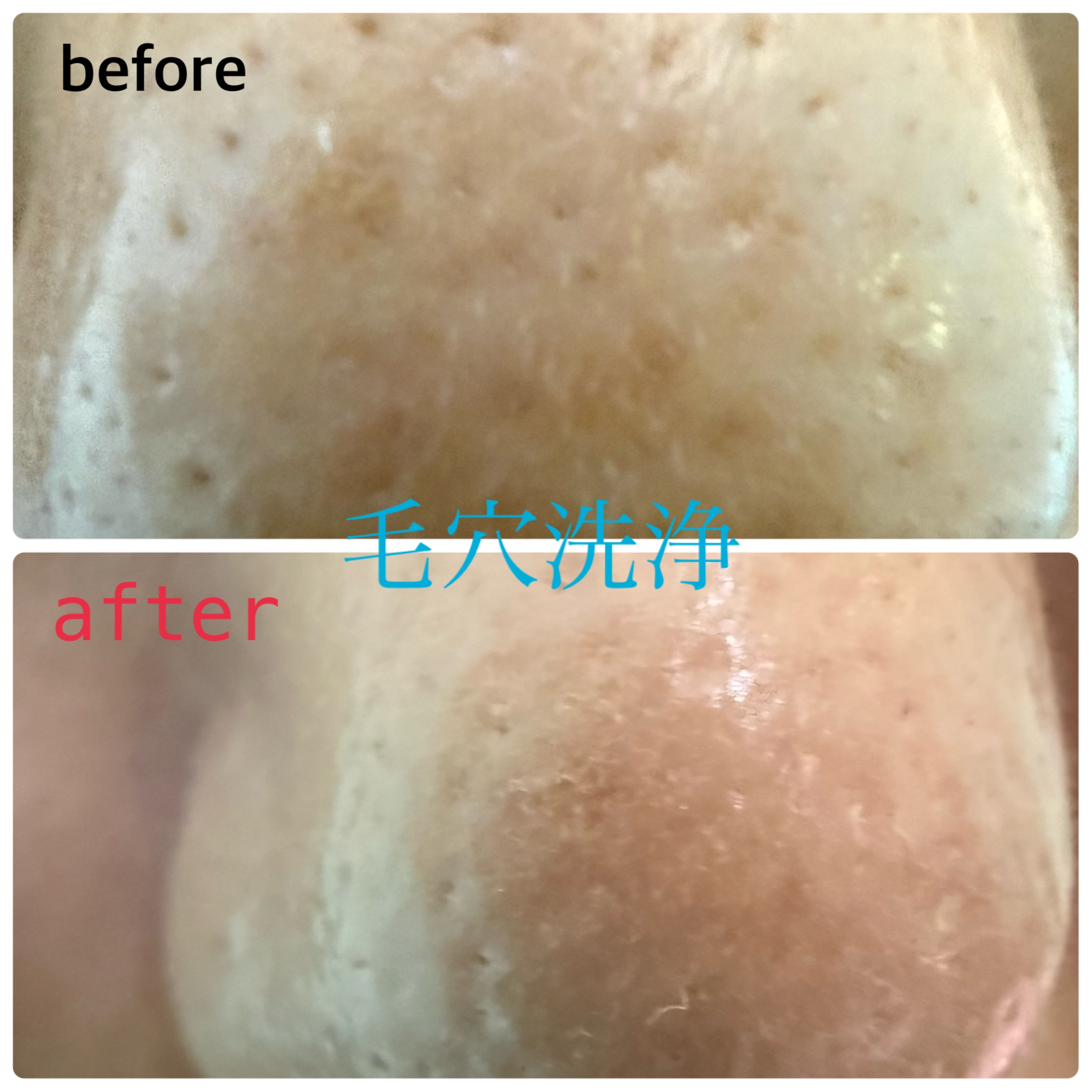 Salon de Bellefemmeの【毛穴の汚れスッキリケア】毛穴洗浄フェイシャルの写真