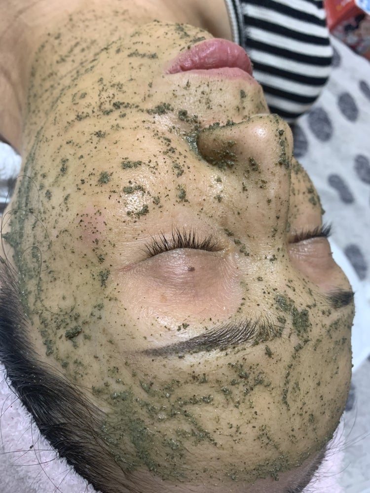 脱毛・ピーリングサロンM  の《人気メニュー》陶肌トリートメント基本コースの写真