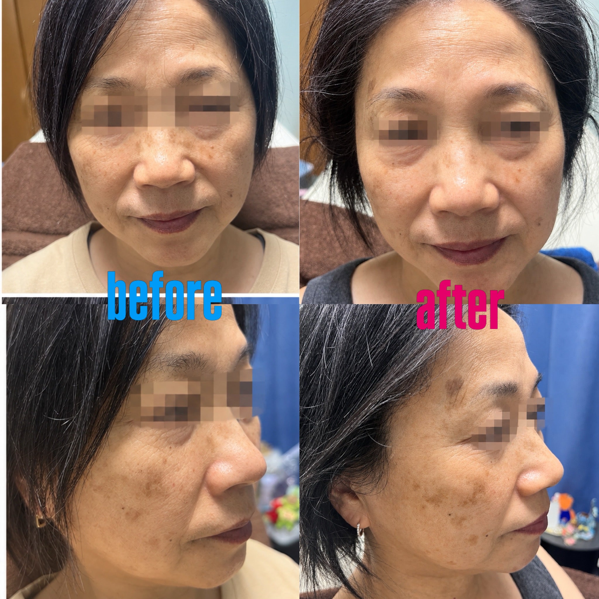 Dryheadspa&amp;CAREBeauty Moco_2枚目