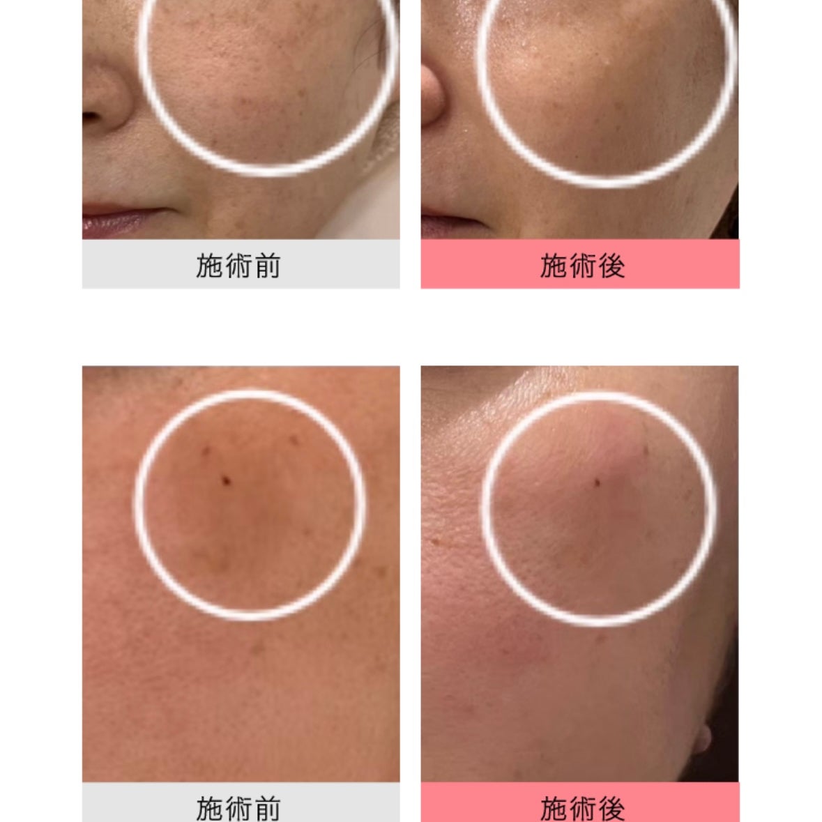 トータルビューティーサロンMint_3枚目