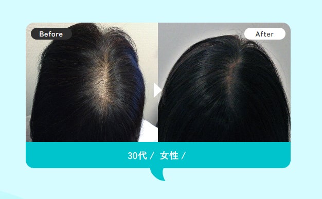スーパースカルプ発毛センター湘南藤沢店【薄毛ケア】の紹介写真_1枚目