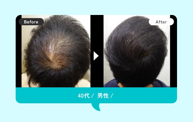 スーパースカルプ発毛センター湘南藤沢店【薄毛ケア】の紹介写真_2枚目