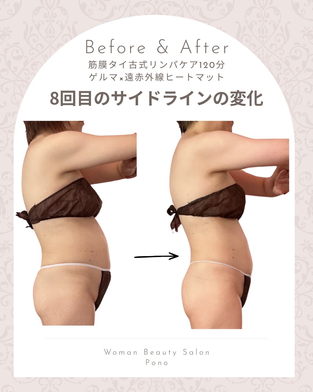 Woman Beauty Salon~Pono~の筋膜タイ古式リンパケア120分の写真