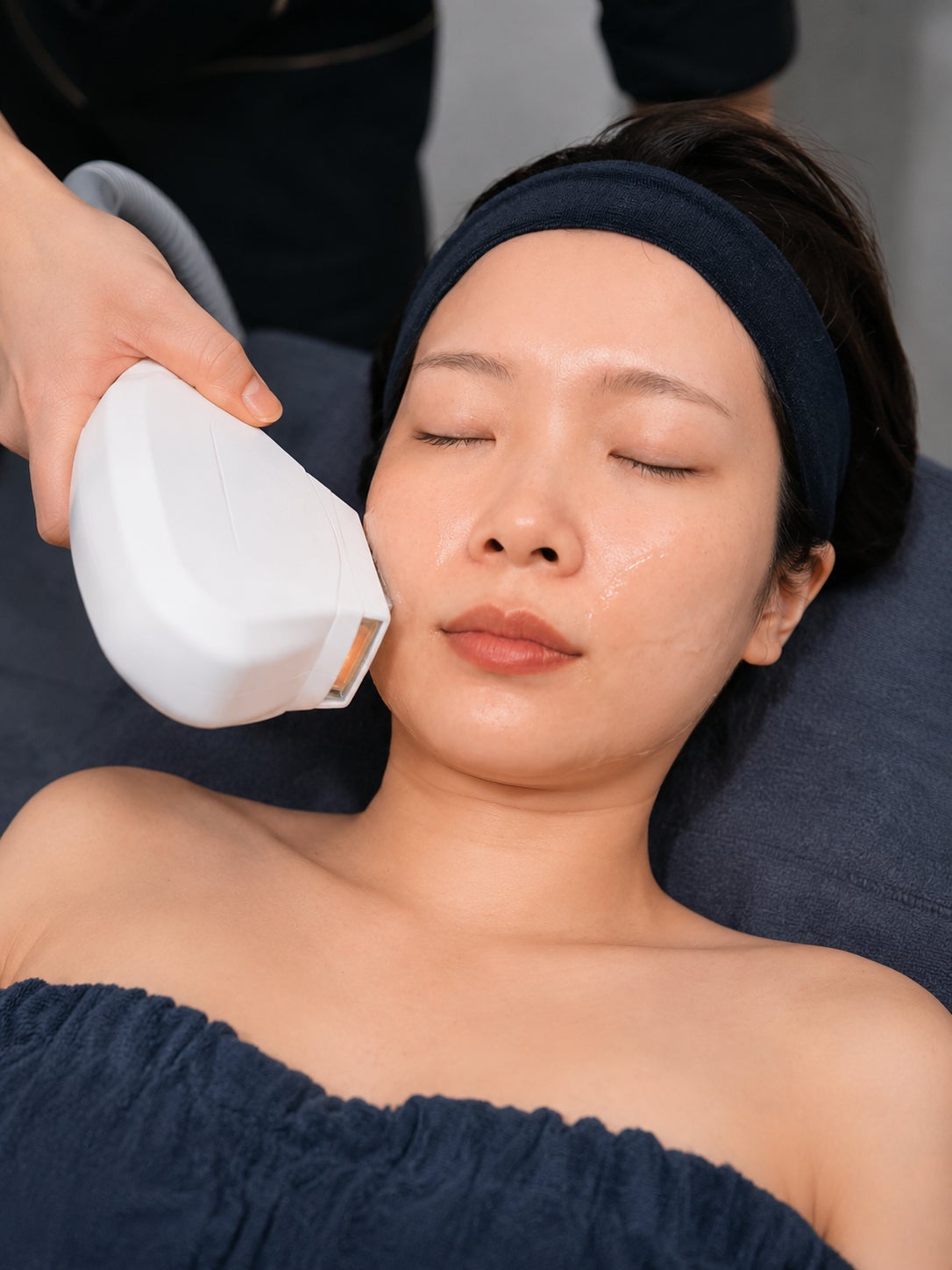 Refineplusの【顔脱毛×RF美肌】産毛ケア＆ハリツヤUP W美肌脱毛通常1回10,000円→3,980円の写真