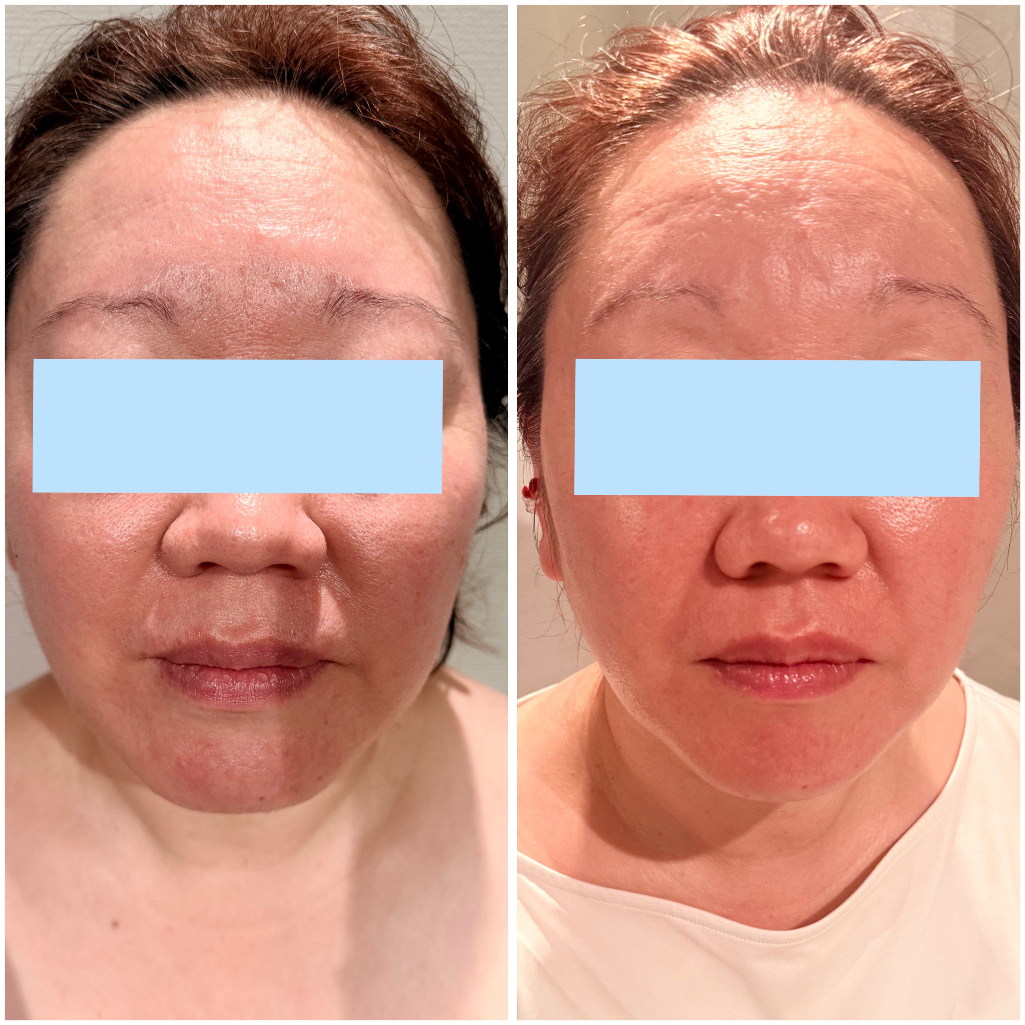 藤沢メンズレディース脱毛　Total Beauty Salon moshimo_1枚目