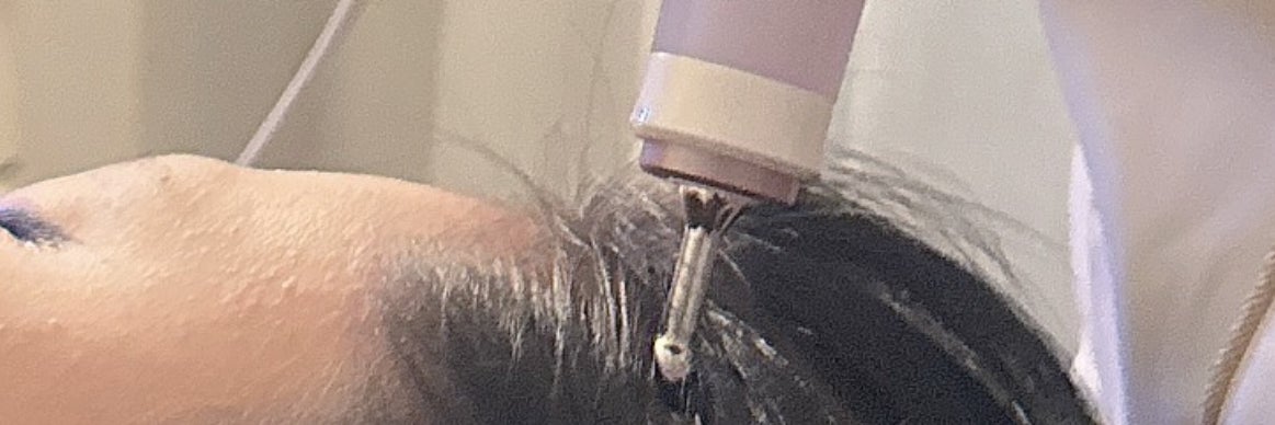 L eclat _Scalp Care