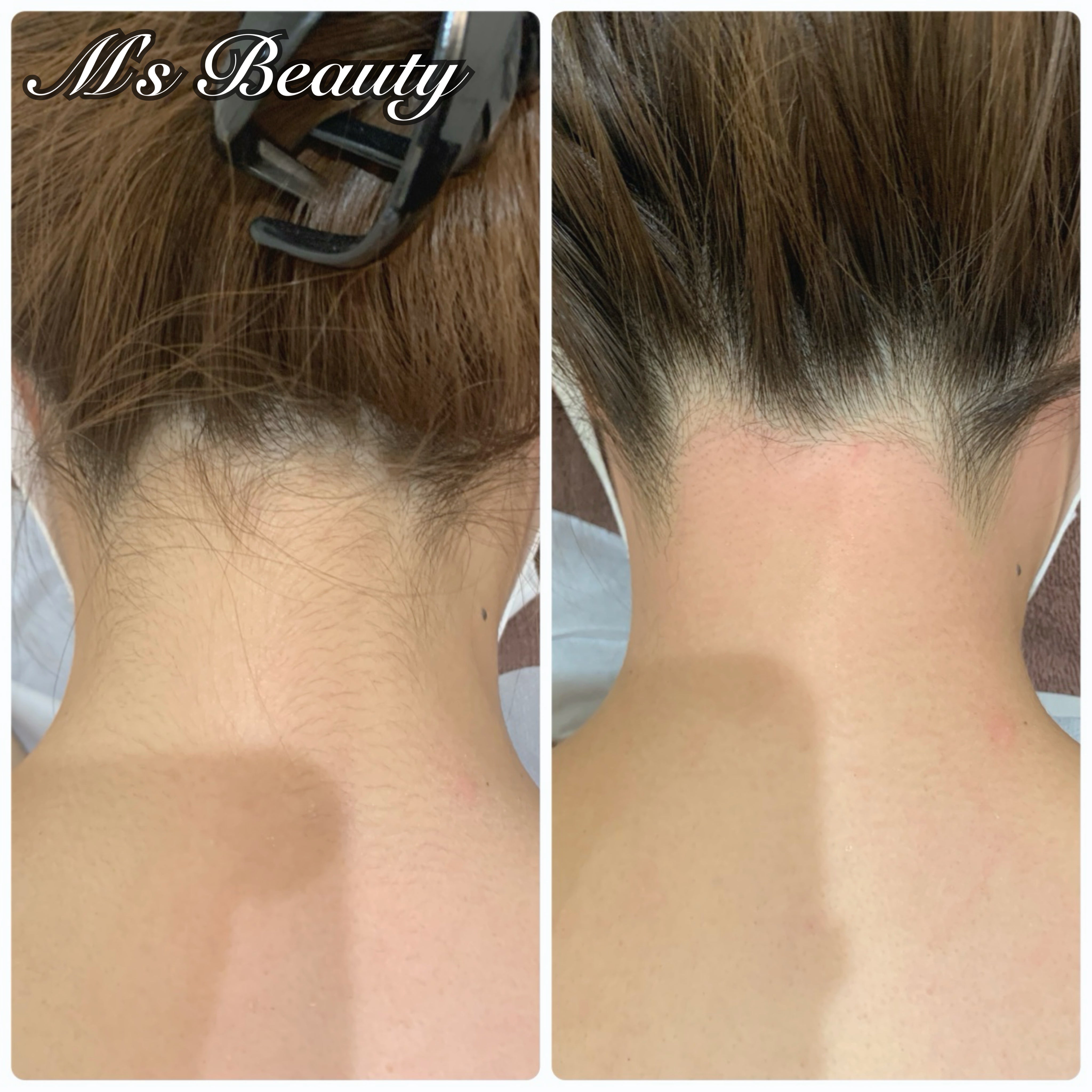 美肌脱毛専門店　M's Beauty_3枚目
