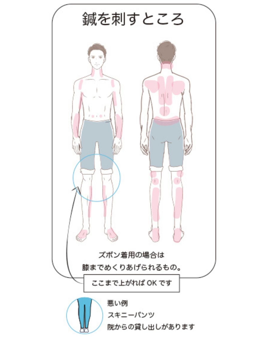 はじめての鍼灸・美容鍼をご検討の方へ｜よくあるご質問とご来院時の服装のご案内の写真
