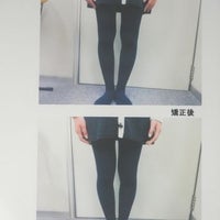 竹田整体院のO脚・X脚矯正の写真