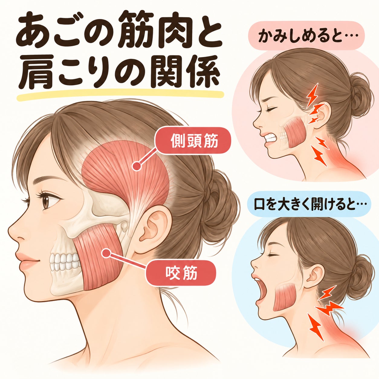 かみしめ・食いしばりと肩こり①の写真