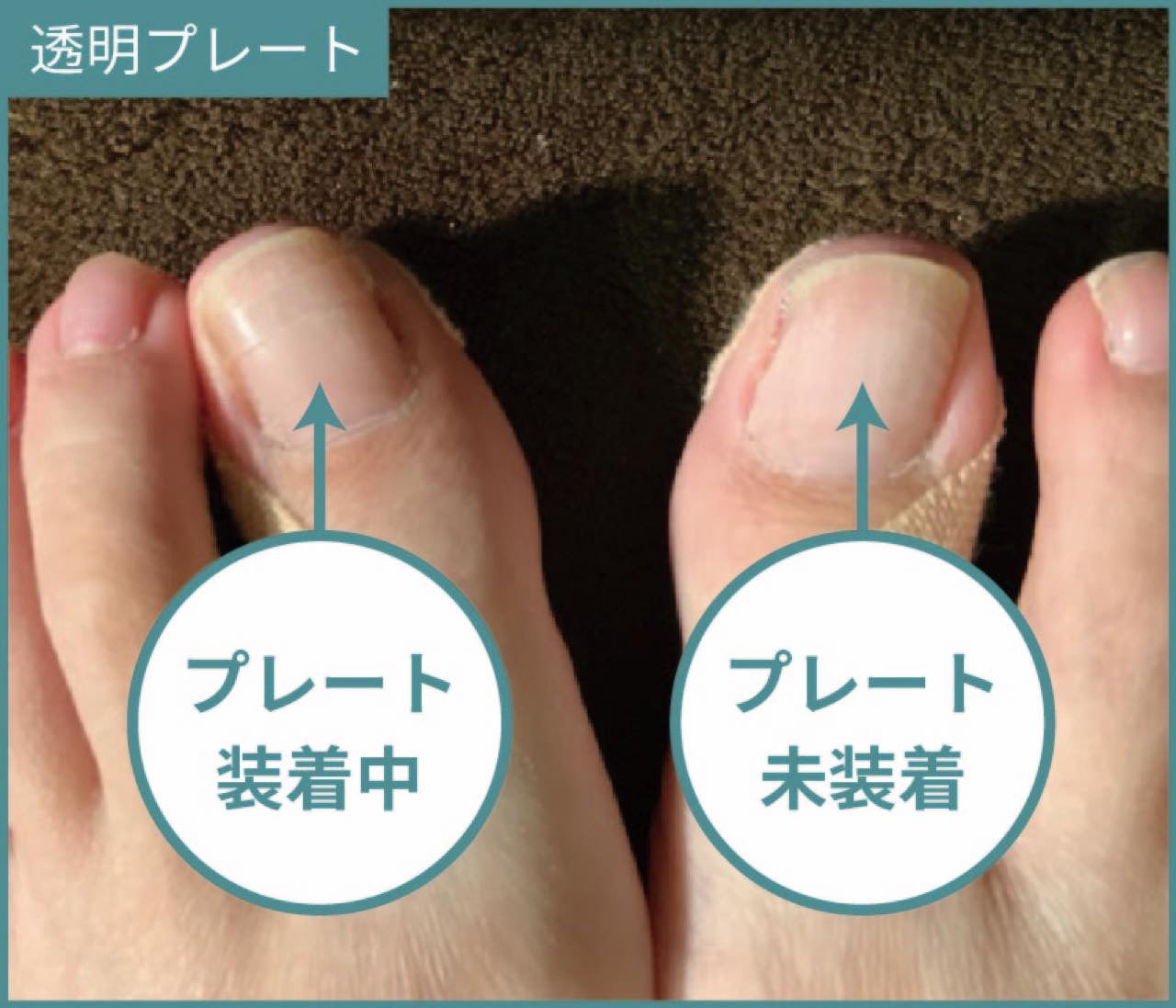 巻き爪研究所 成増院_3枚目