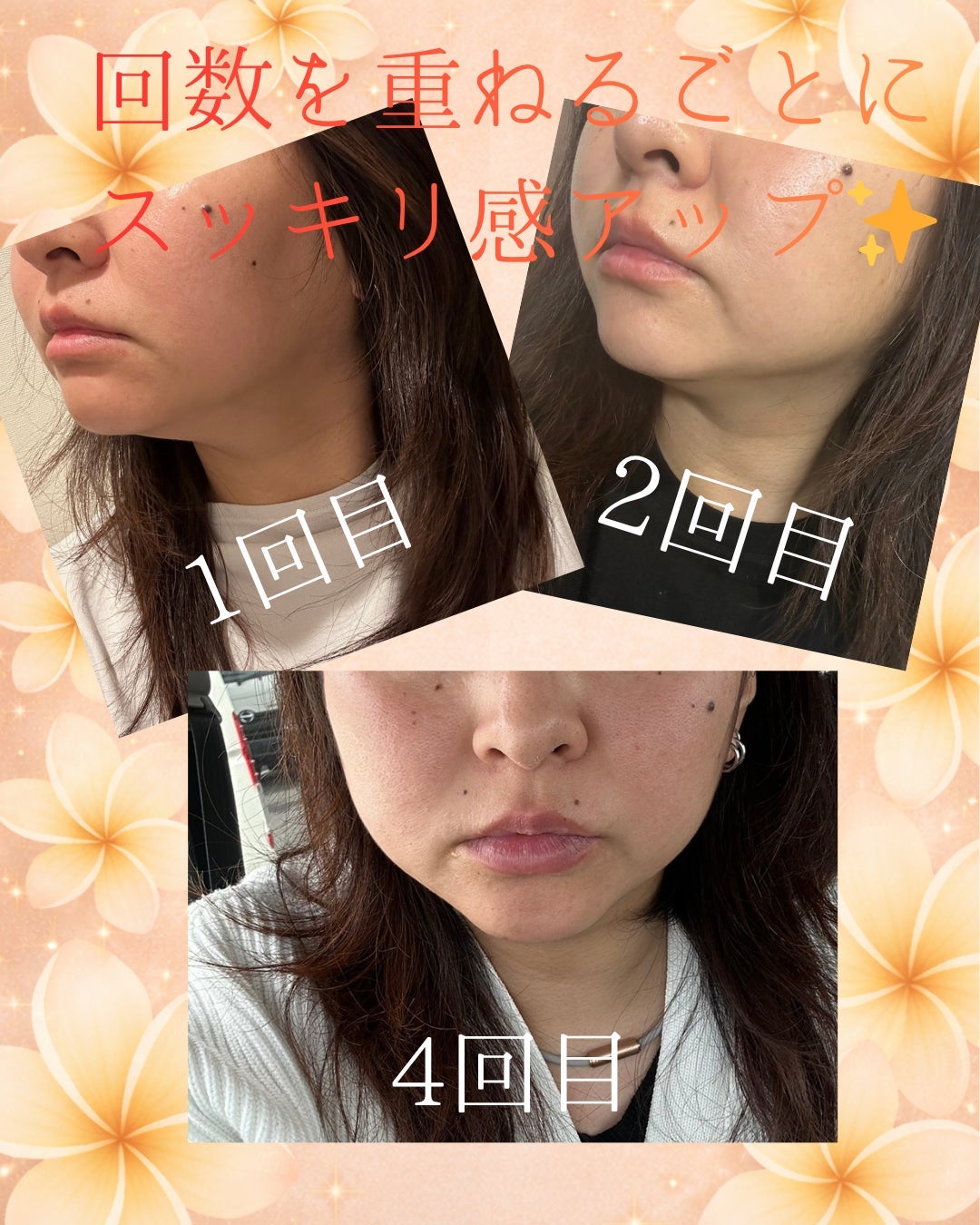 エクラボーテのフェイシャルケアの写真