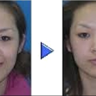 富士健康美容サロンの小顔美矯正（からだのバランスを整える骨盤調整付き）の写真