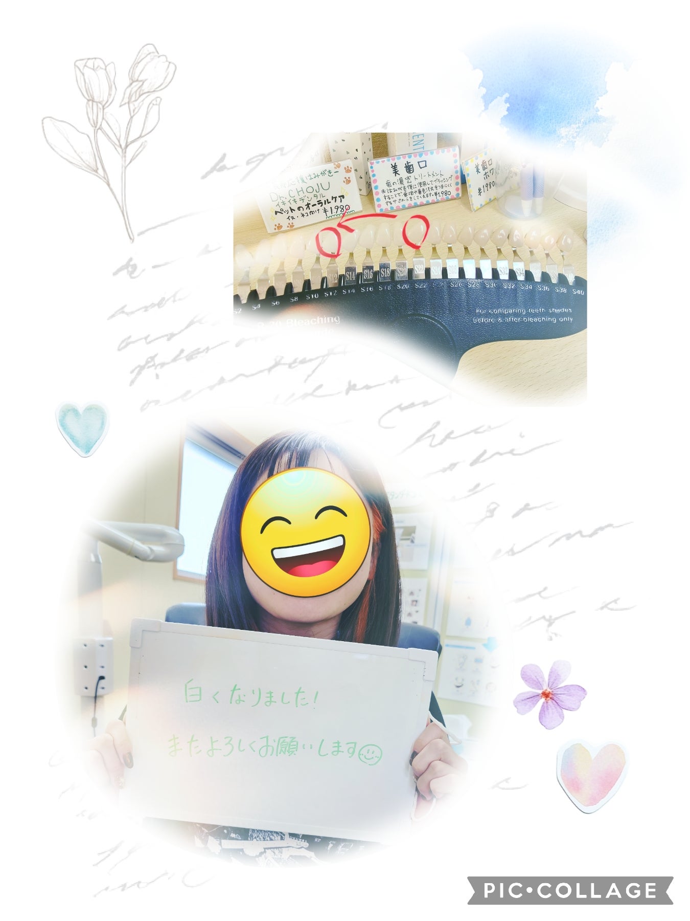 春に向けて歯のエステ❇️の写真