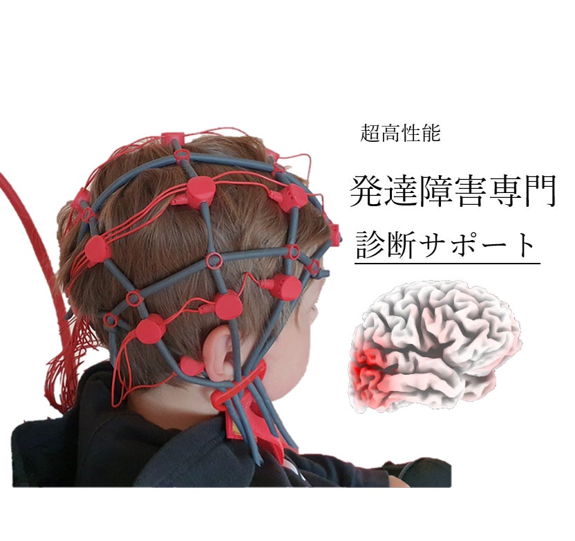東京メンタルヘルスサロンの発達障害専門 超高性能 デジタル脳機能解析QEEGの写真