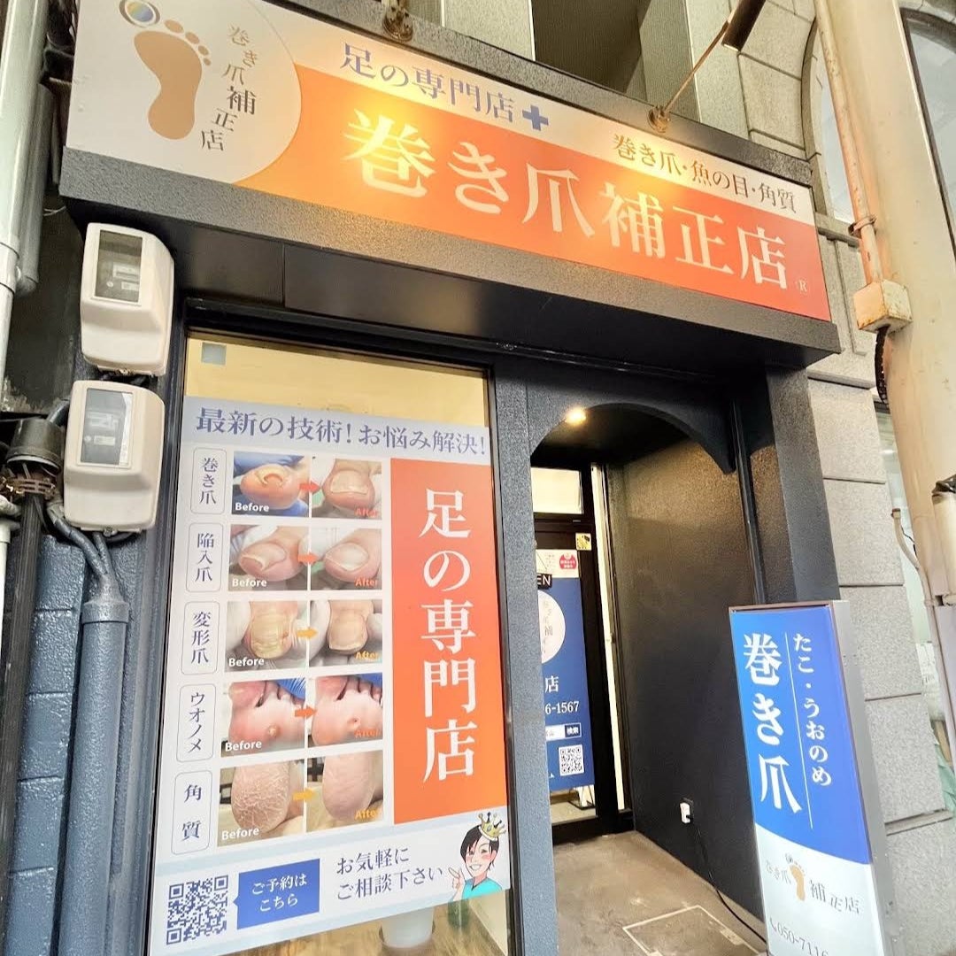 巻き爪補正店 富山店（富山市中央通り）_1枚目