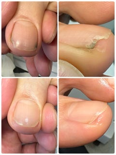 ドクターネイル爪革命岸和田店のプロの爪切り（～３０分）の写真