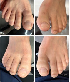 ドクターネイル爪革命岸和田店のトータルフットケア（～９０分）の写真