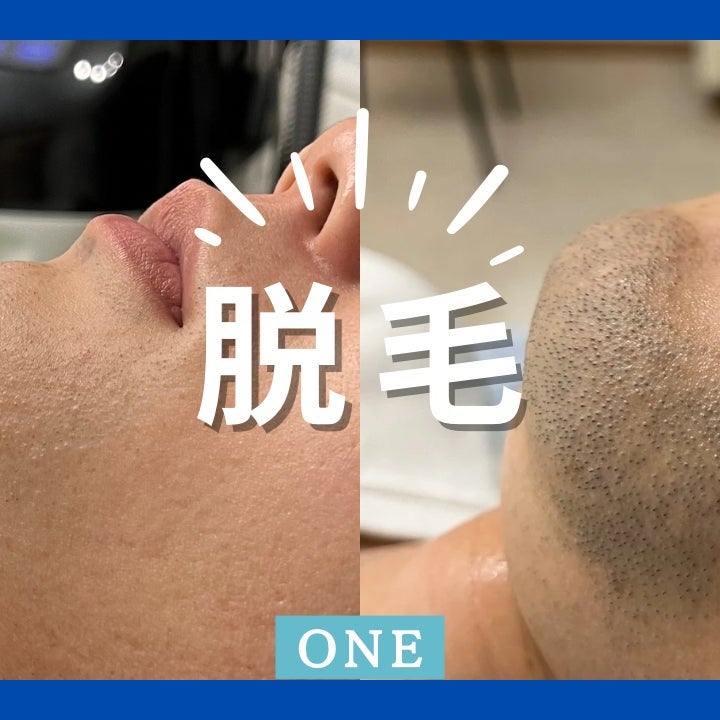 ONE_3枚目