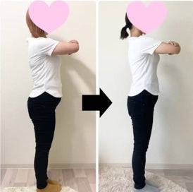 理想のシルエットを目指す美容整体の写真