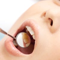 渡辺歯科クリニックの歯周病の写真