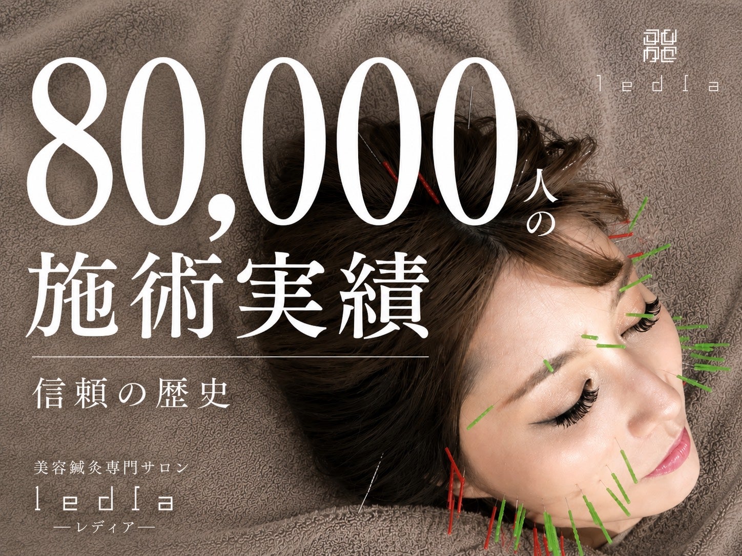 大阪・美容鍼ledia（ルディア）堀江店のお顔と頭皮の美容鍼の写真