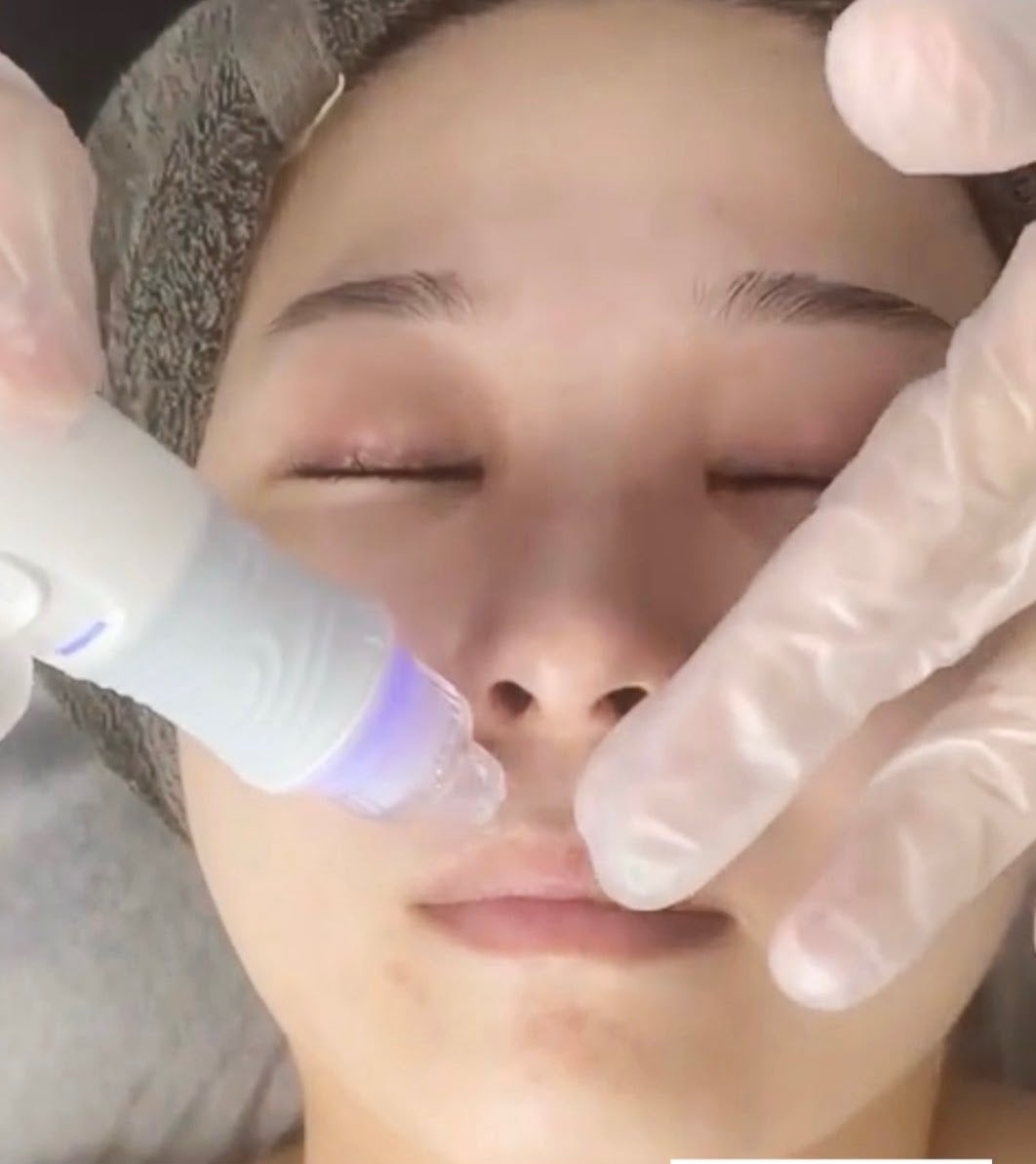 SalonBellｅの毛穴洗浄ケア＋パック＋ヘッドマッサージ　60分　8,000円～の写真