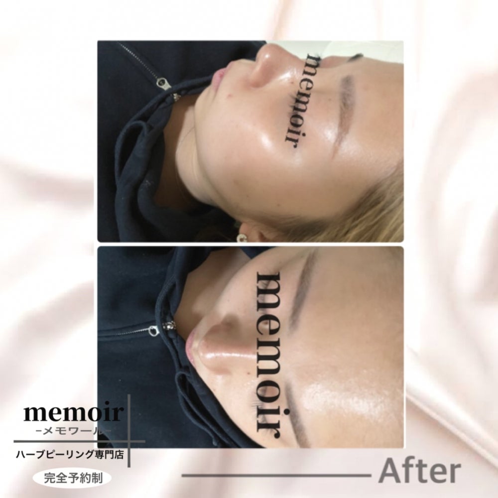 memoir（メモワール）の乾燥肌ケア50分コースの写真