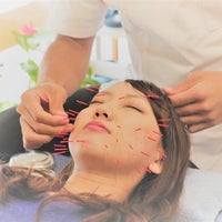 しおやき鍼灸整骨院の【人気メニュー】お顔を美しくする「美容鍼」を試してみませんか？の写真