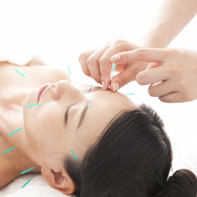 日本橋KIZUNA鍼灸整骨院のオーダーメイド美容鍼の写真