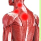 坂東接骨院の寝違え（筋肉の炎症）・肩こりの写真