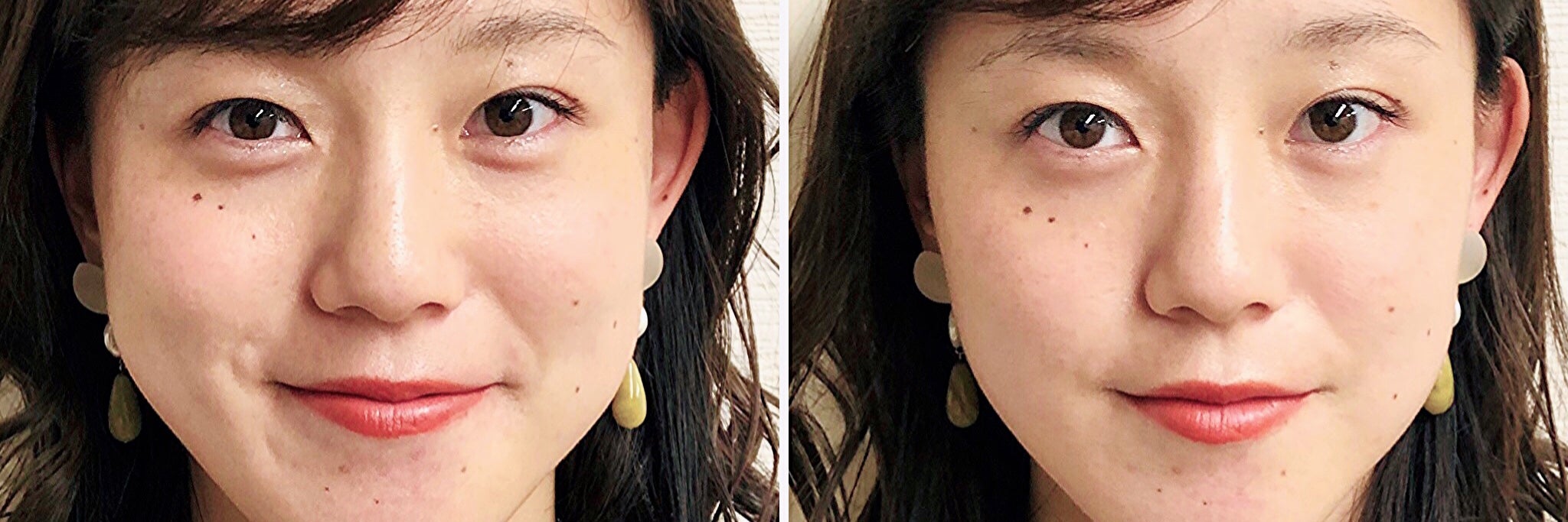 AOYAMA SALON YZ