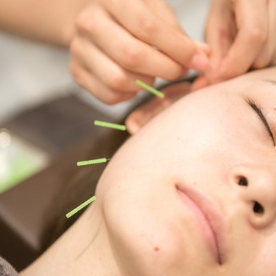 ReCORE鍼灸接骨院 西九条の「美顔鍼灸」リフトアップ・たるみ・しわ・シミなどに効果的！の写真