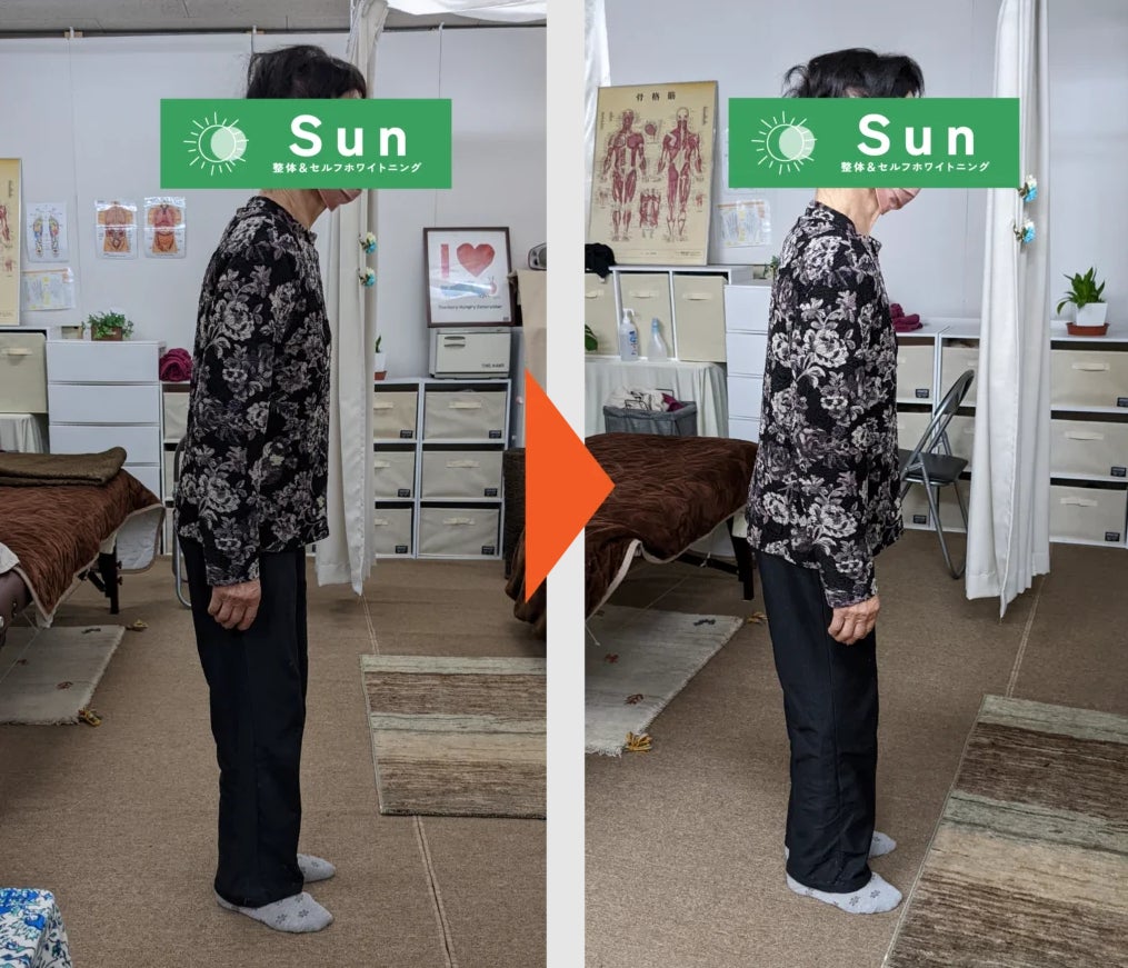 整体&セルフホワイトニング　Sunの紹介写真_1枚目