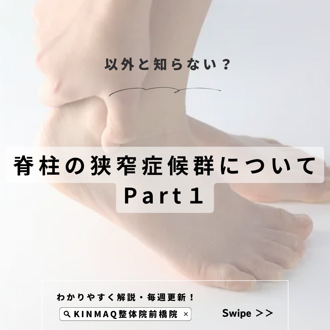 脊柱の狭窄症候群についてPart１の写真
