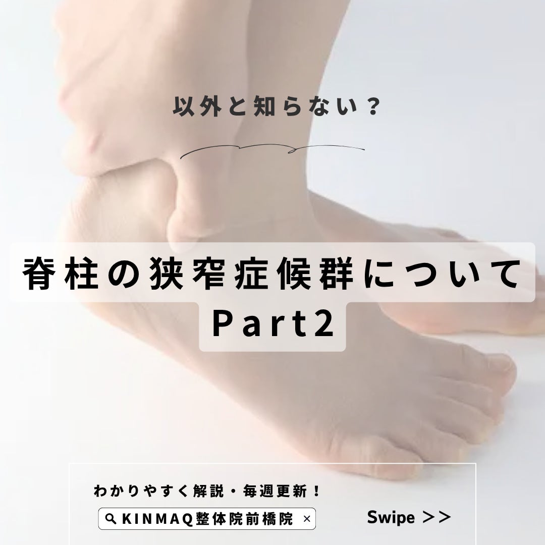 脊柱の狭窄症候群についてPart２の写真