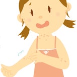 池袋皮膚科の湿疹・蕁麻疹・皮膚炎の写真
