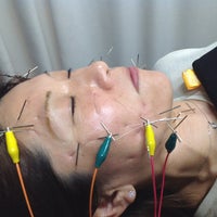 やすだ鍼灸接骨院の名古屋流アンチエイジング美容鍼の写真