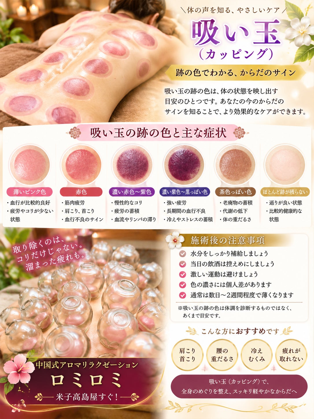 吸い玉(カッピング）で体のサインをチェックの写真