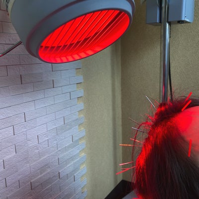 【メディカルジャパン立川】鍼灸院･整体院･マッサージ院の頭皮ケアコース 6500の写真