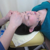 篠崎つばさ整骨院・鍼灸院の刺激の少ない鍼の写真